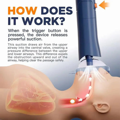 Sonmol Portable Choking Rescue Device